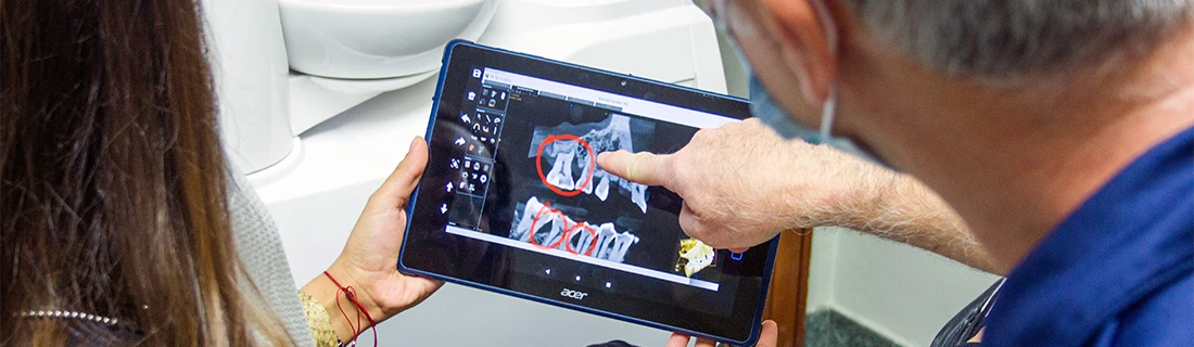 FC – Dental Implant at Dental Care Center In Fremont CA